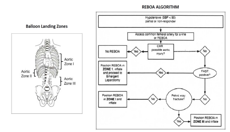 Reboa Graph reboa – SCOPE